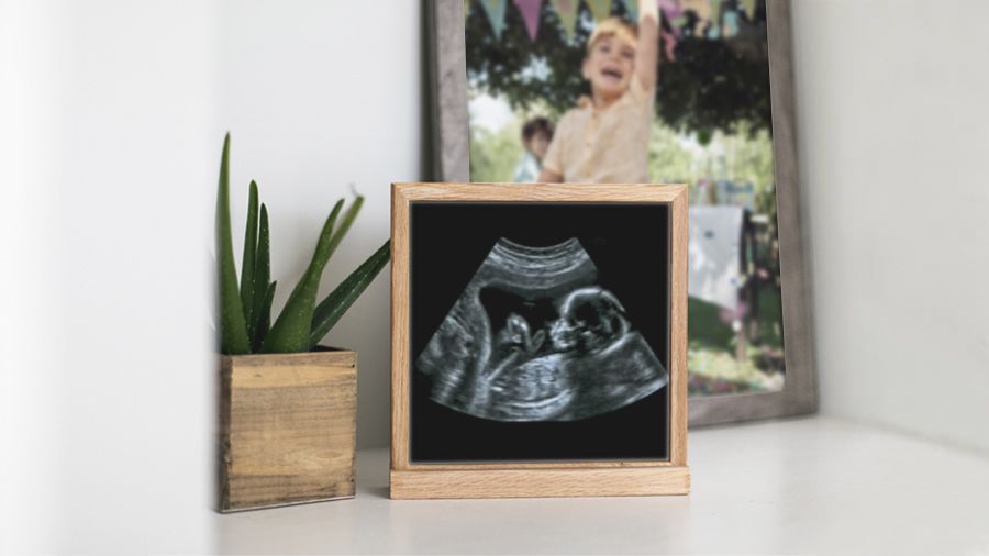 Auf einer weißen Fläche steht neben einer kleinen Topfpflanze ein gerahmtes Ultraschallbild, im Hintergrund ist ein unscharfes Foto eines Kindes zu sehen.
